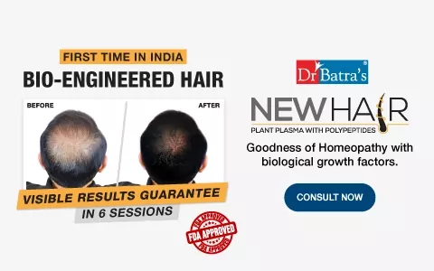 Alopecia is caused by an... - Dr. Batra's, Brahmapur | Facebook